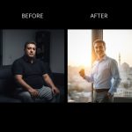 عمل جراحی اسلیو معده چیست؟‌ | جامع مزایا و معایب